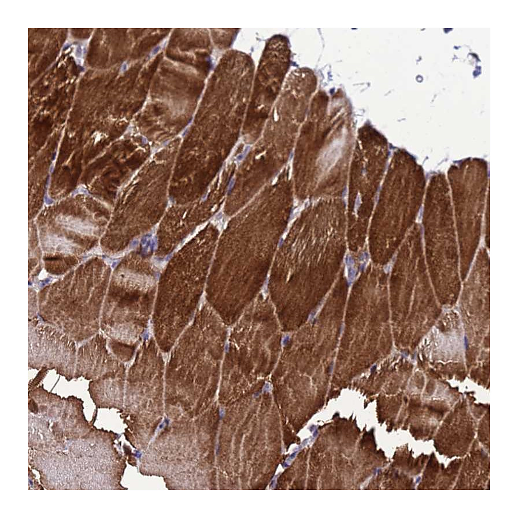 Atlas Antibodies Anti-GZF1 Antibody