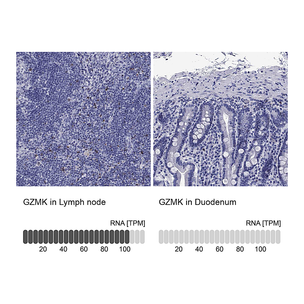 Atlas Antibodies Anti-GZMK Antibody