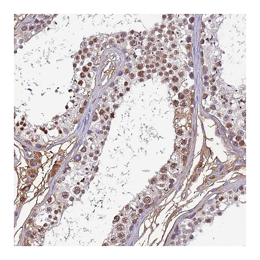 Atlas Antibodies Anti-H1FNT Antibody