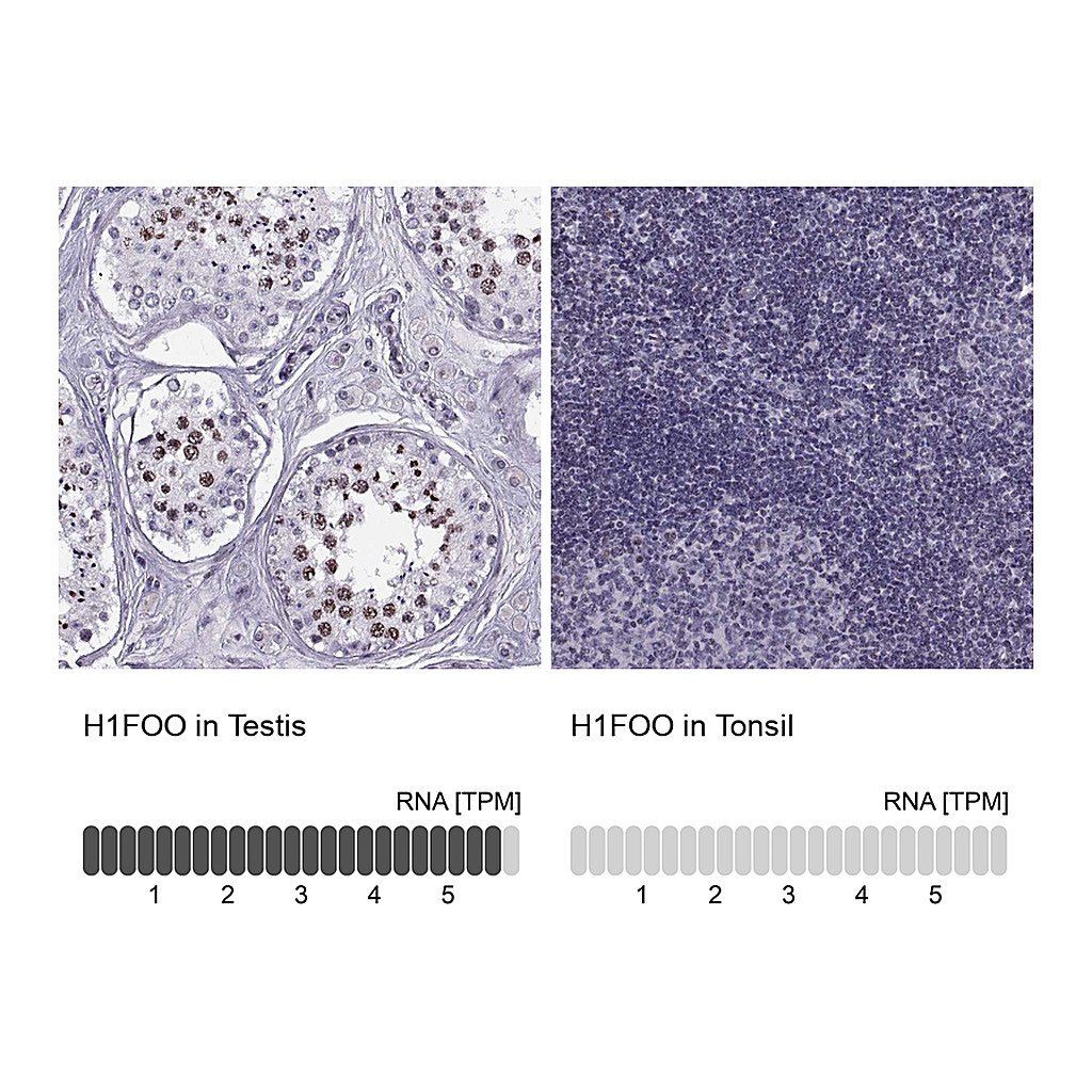Atlas Antibodies Anti-H1FOO Antibody