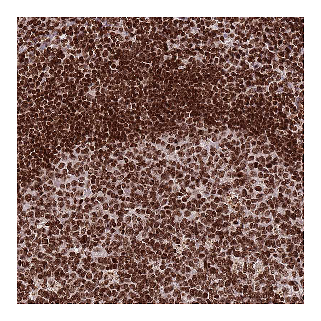 Atlas Antibodies Anti-H3F3A Antibody