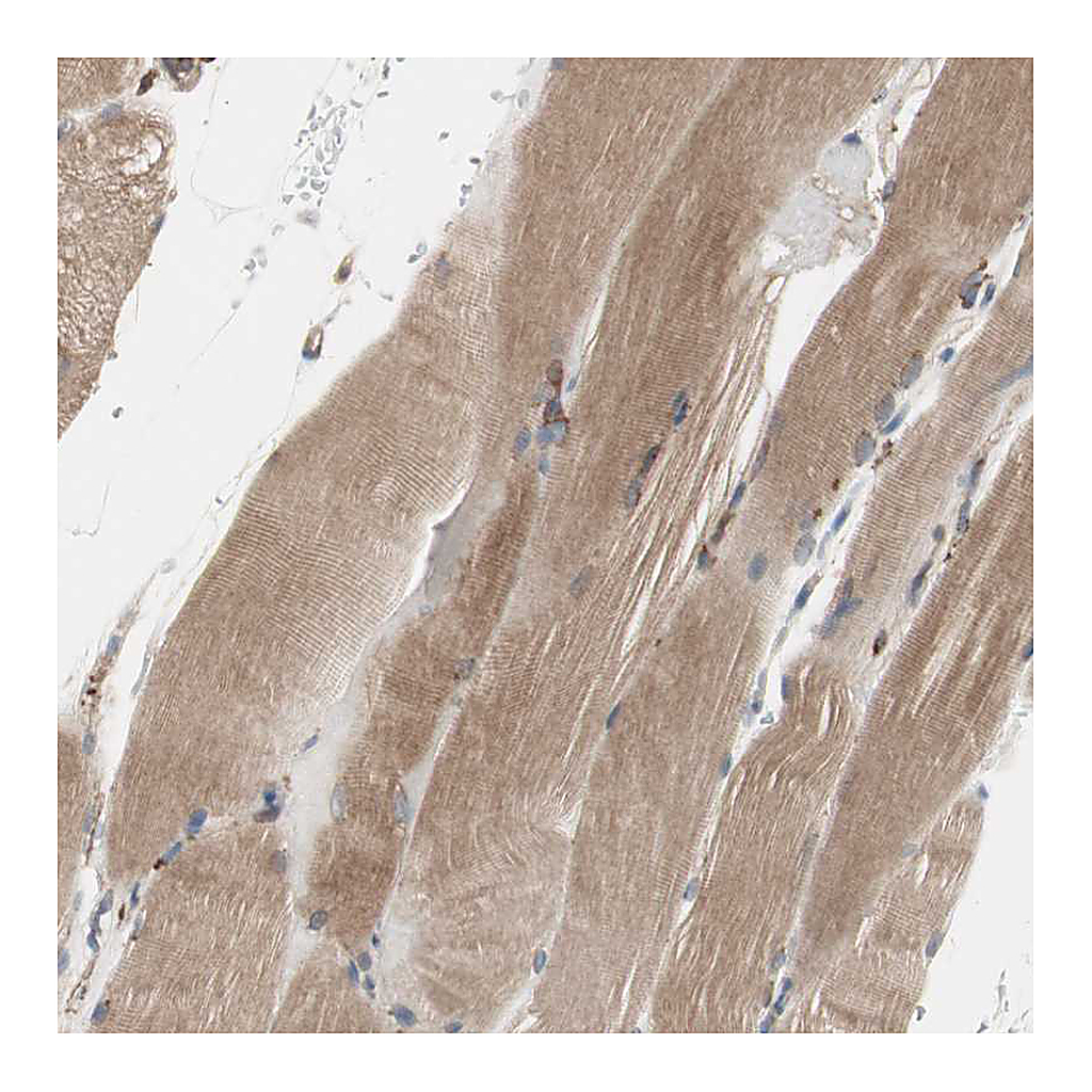 Atlas Antibodies Anti-H6PD Antibody