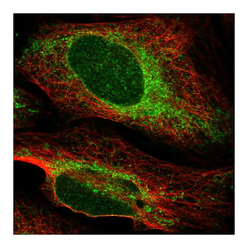 Atlas Antibodies Anti-HACD3 Antibody