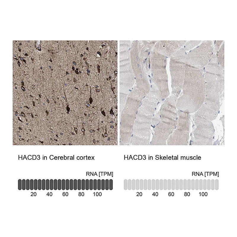 Atlas Antibodies Anti-HACD3 Antibody