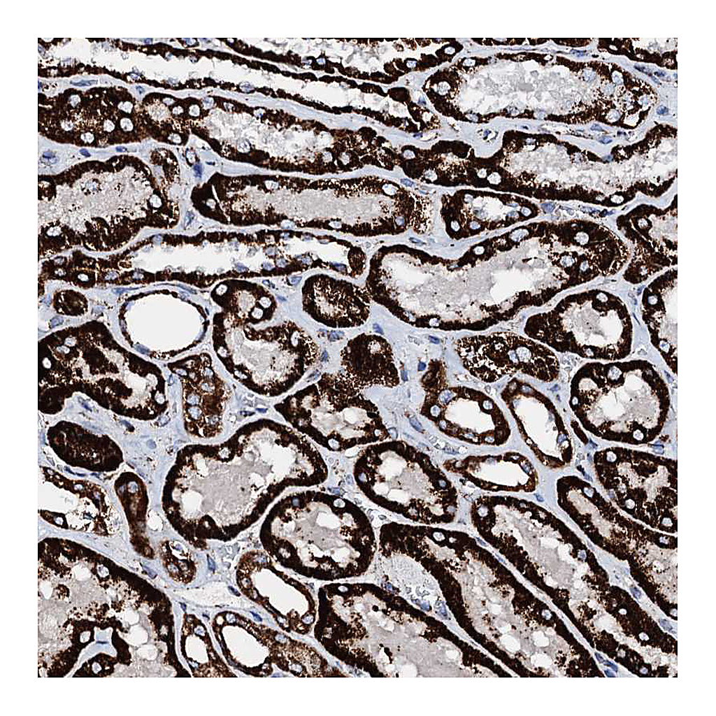 Atlas Antibodies Anti-HADH Antibody