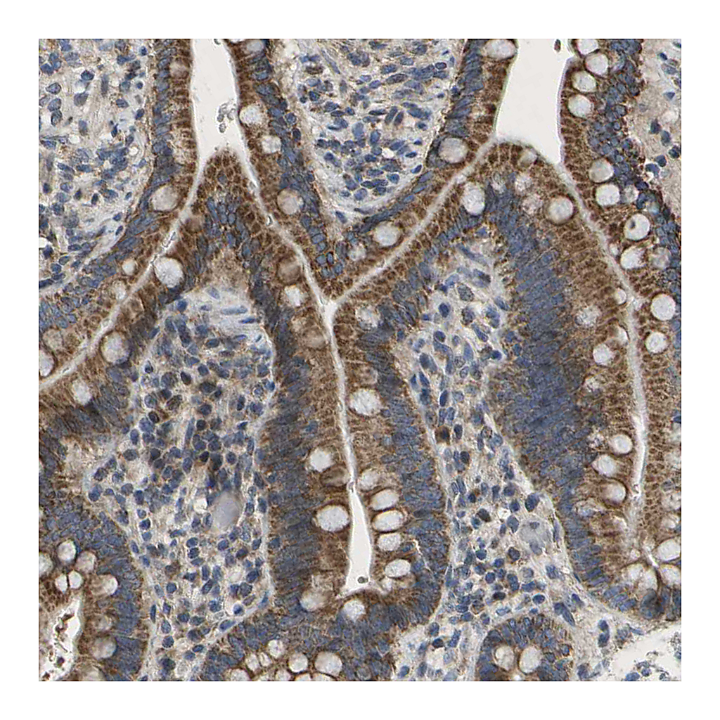 Atlas Antibodies Anti-HADHA Antibody