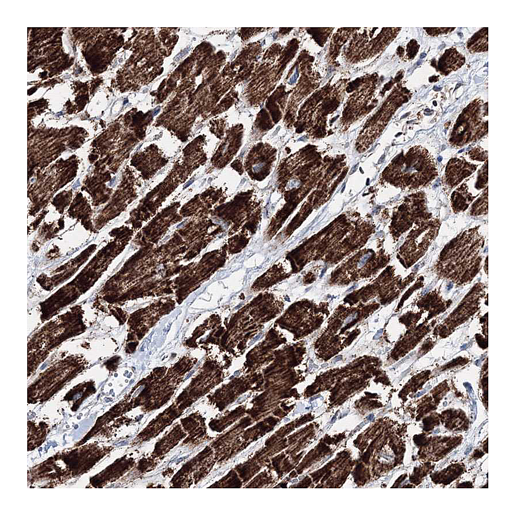 Atlas Antibodies Anti-HADHB Antibody