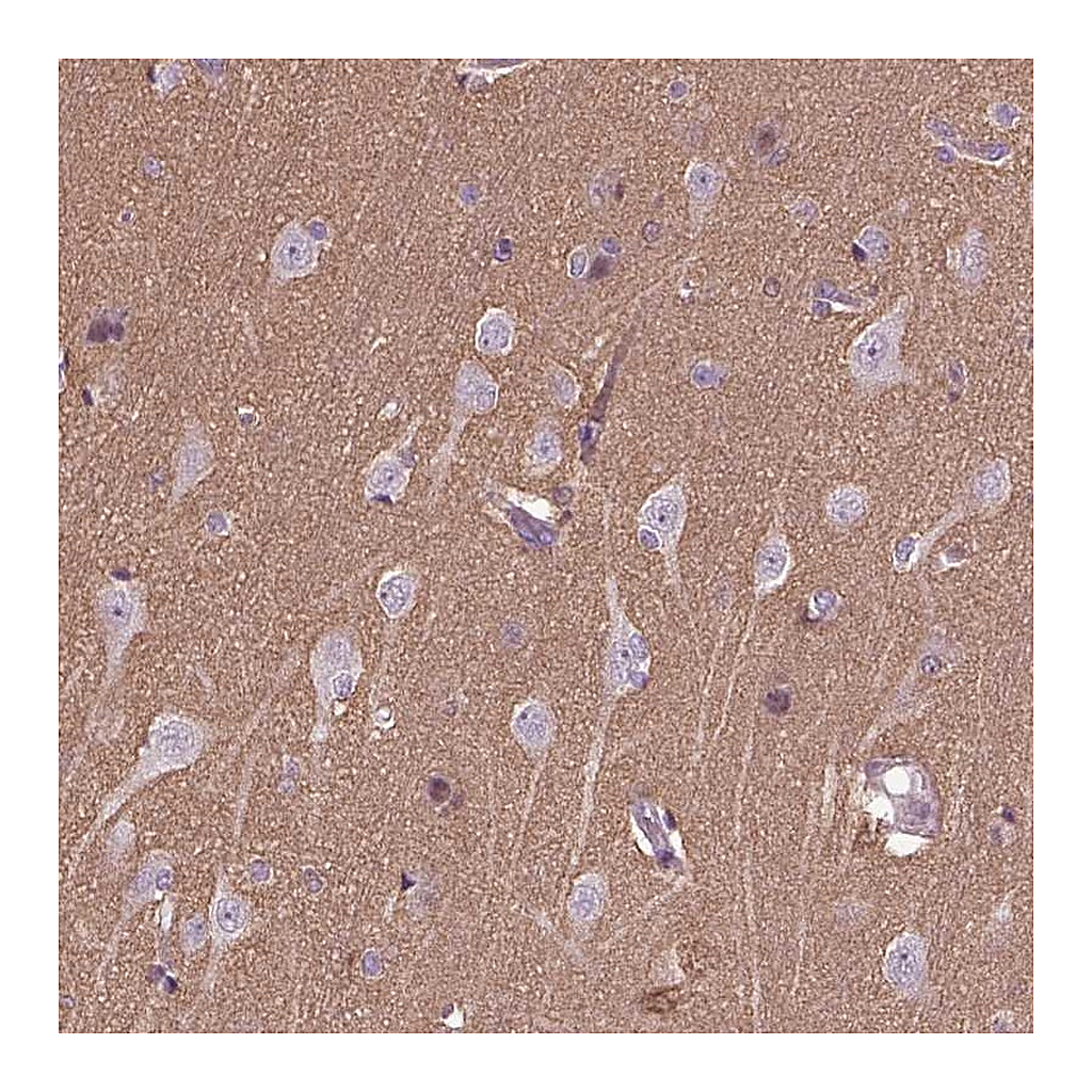 Atlas Antibodies Anti-HAGHL Antibody
