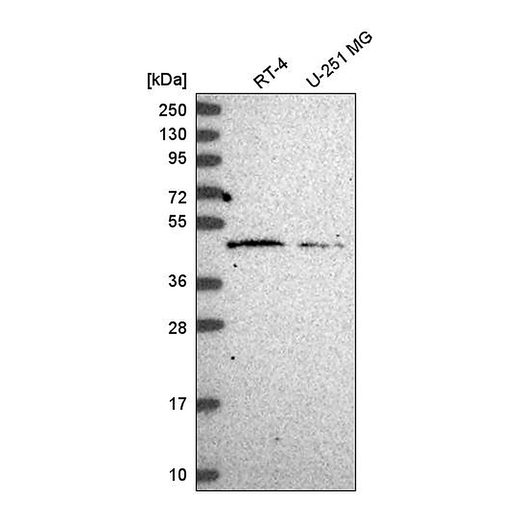 Atlas Antibodies Anti-HARBI1 Antibody
