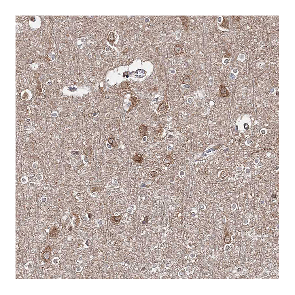Atlas Antibodies Anti-HARS Antibody
