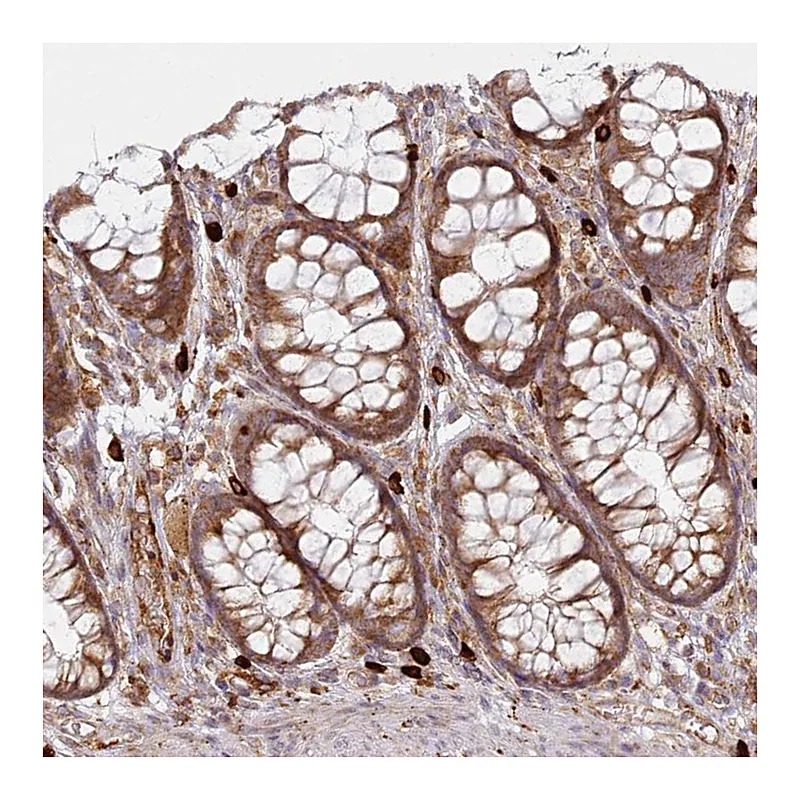 Atlas Antibodies Anti-HARS2 Antibody