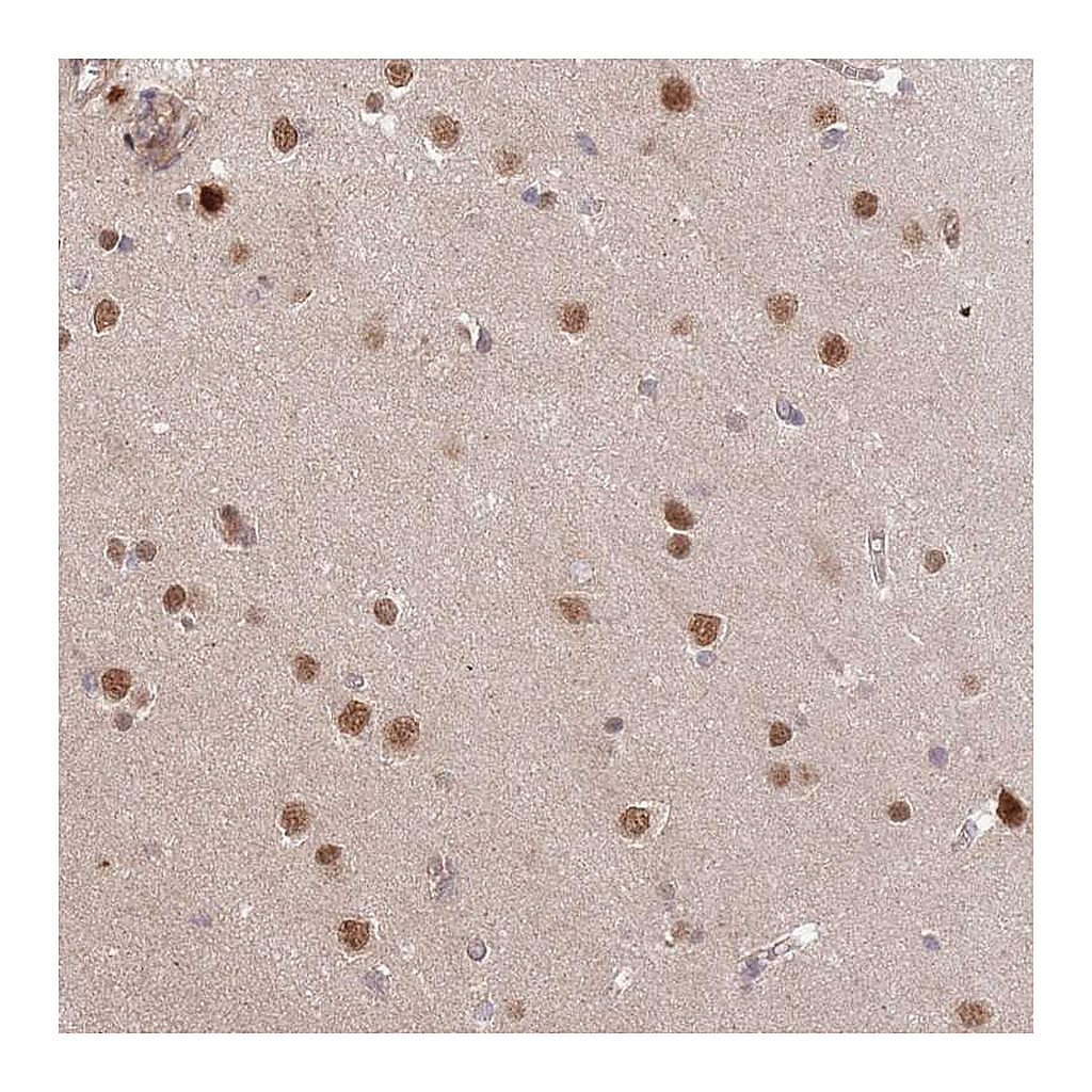 Atlas Antibodies Anti-HAUS3 Antibody
