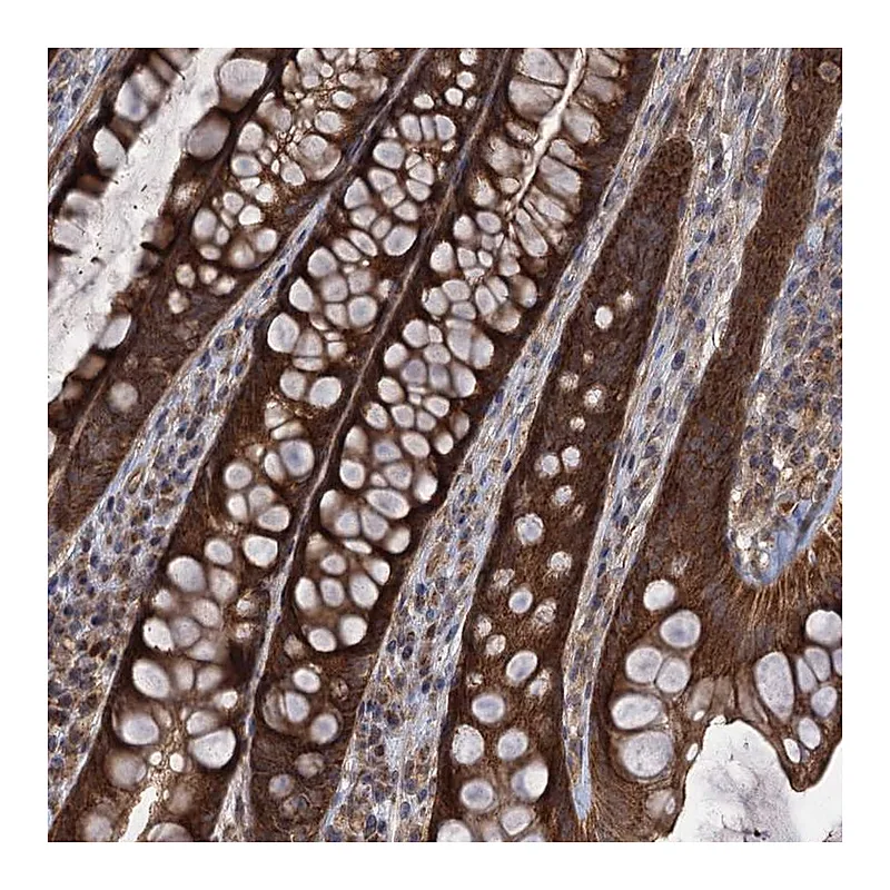 Atlas Antibodies Anti-HAUS1 Antibody