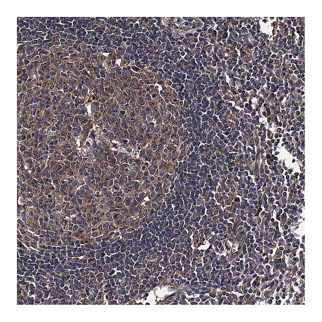 Atlas Antibodies Anti-HAUS1 Antibody