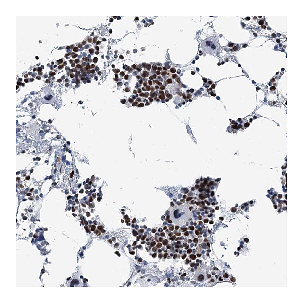 Atlas Antibodies Anti-HAT1 Antibody
