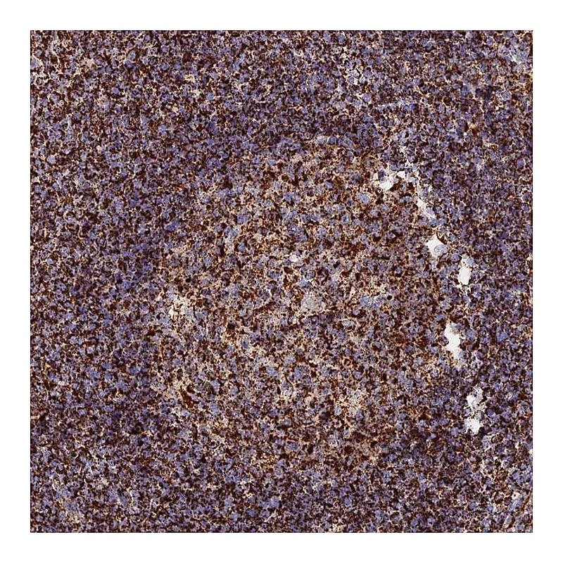 Atlas Antibodies Anti-HAUS8 Antibody