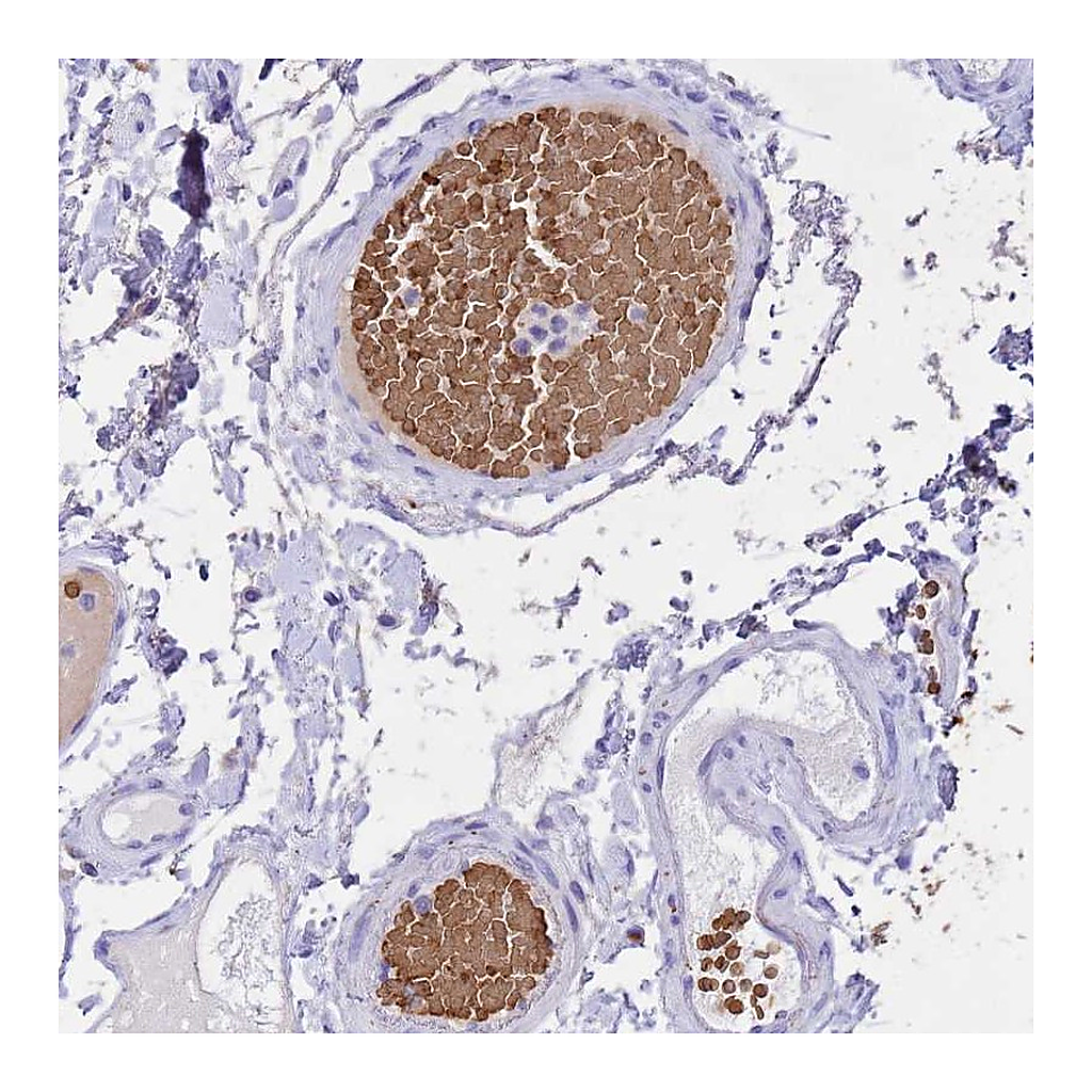 Atlas Antibodies Anti-HBA1 Antibody