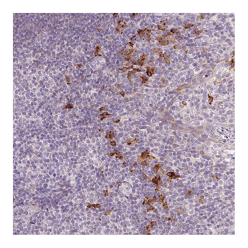 Atlas Antibodies Anti-HAX1 Antibody