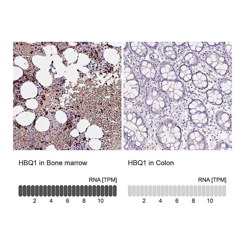Atlas Antibodies Anti-HBQ1 Antibody
