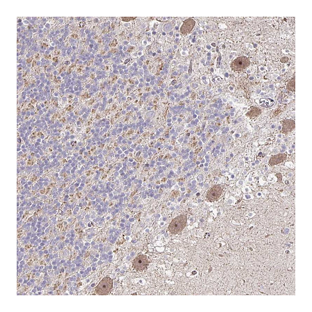 Atlas Antibodies Anti-HCFC1R1 Antibody