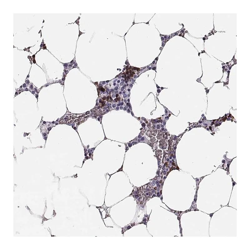 Atlas Antibodies Anti-HBZ Antibody