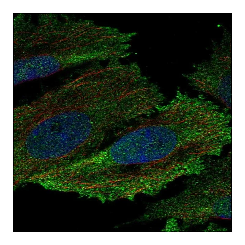 Atlas Antibodies Anti-HCK Antibody