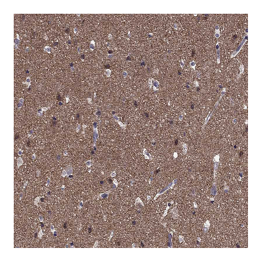 Atlas Antibodies Anti-HCN1 Antibody