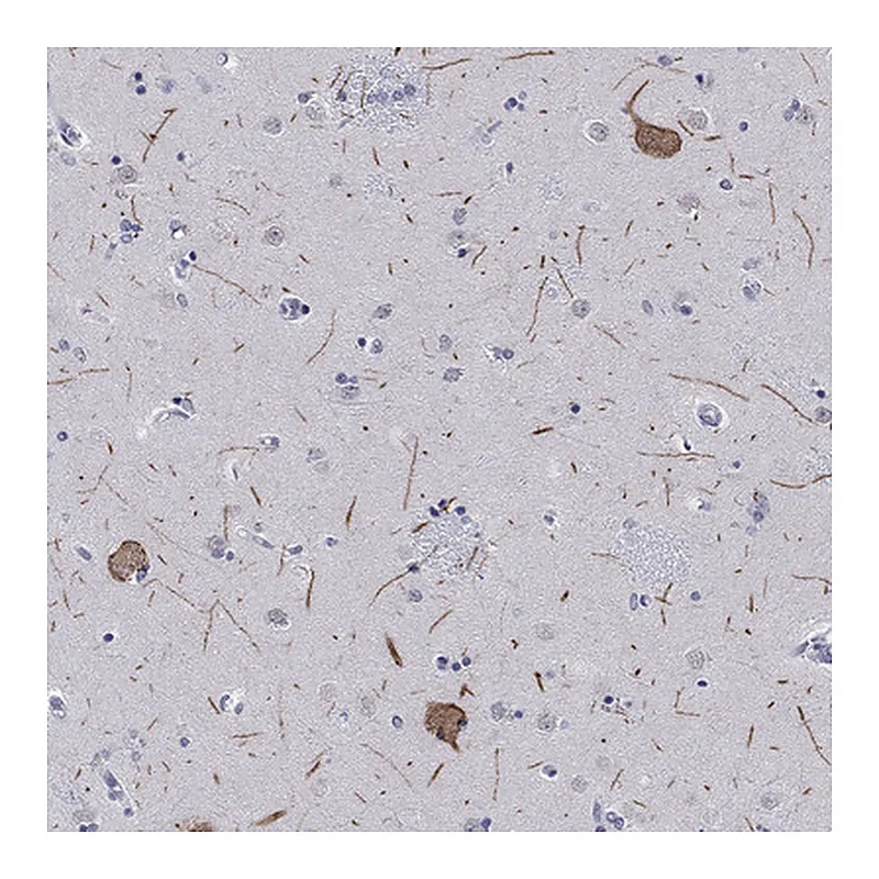 Atlas Antibodies Anti-HCN4 Antibody