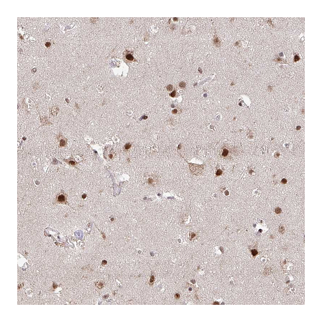 Atlas Antibodies Anti-HDAC3 Antibody
