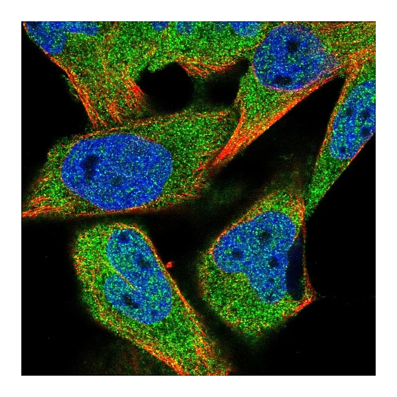 Atlas Antibodies Anti-HDAC4 Antibody