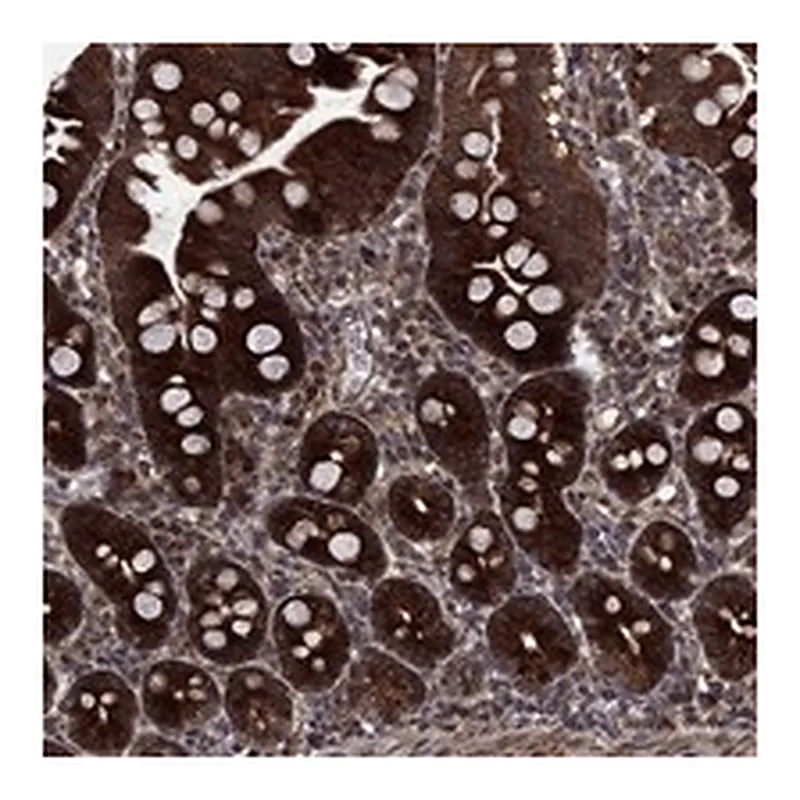 Atlas Antibodies Anti-HDAC4 Antibody