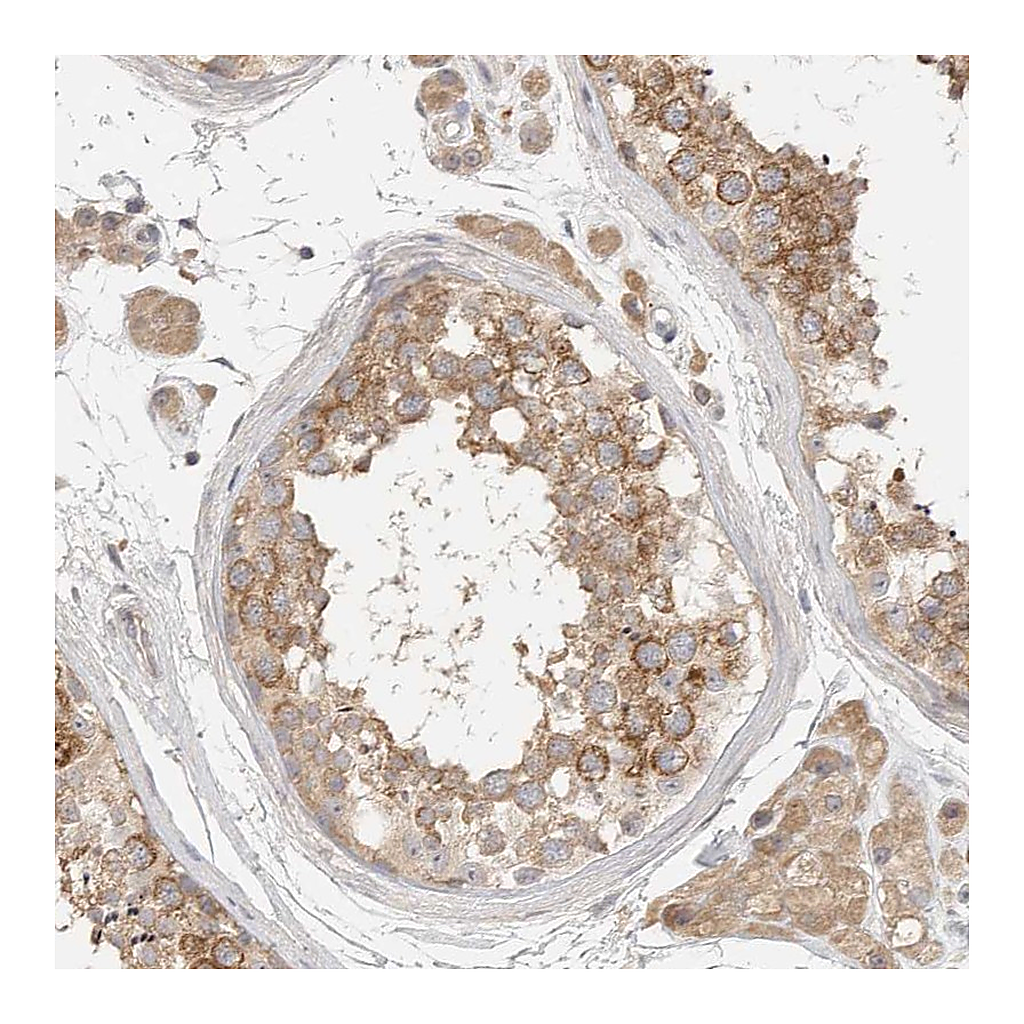 Atlas Antibodies Anti-HDAC6 Antibody