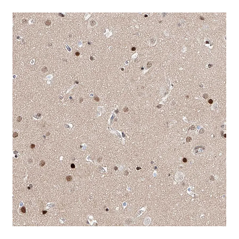 Atlas Antibodies Anti-HDAC9 Antibody