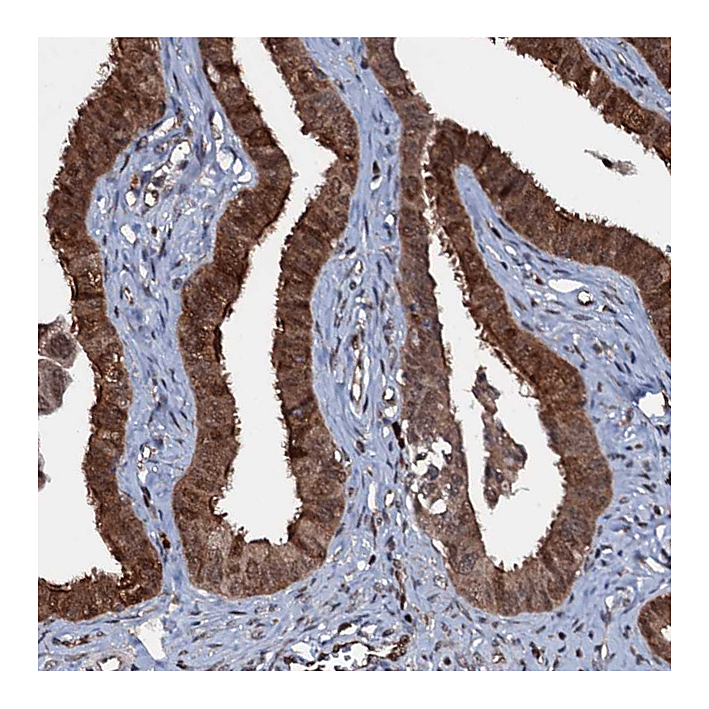 Atlas Antibodies Anti-HDDC3 Antibody