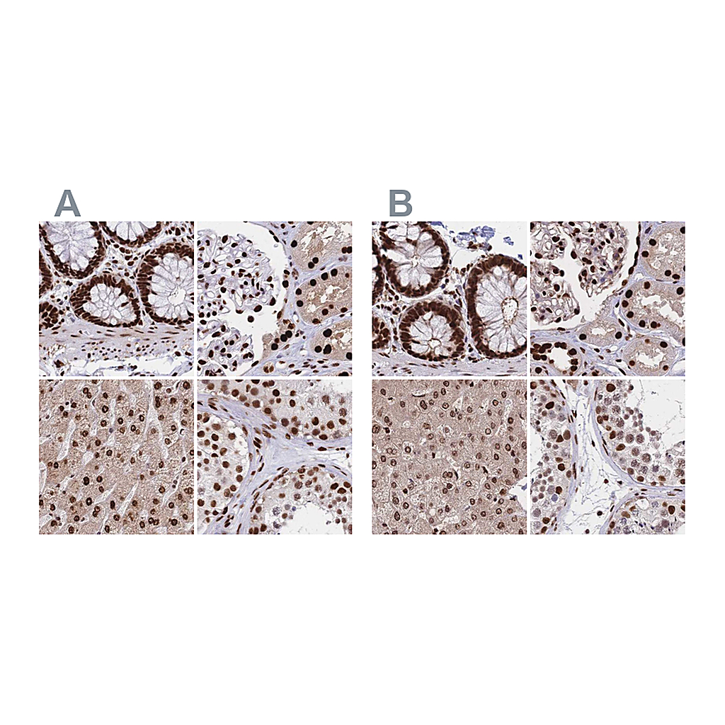 Atlas Antibodies Anti-HDGF Antibody