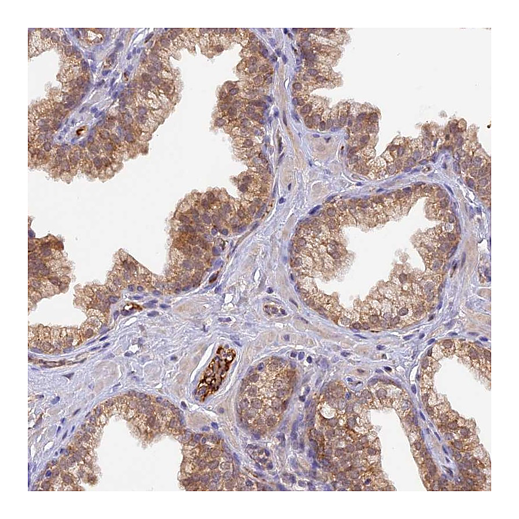 Atlas Antibodies Anti-HDHD2 Antibody