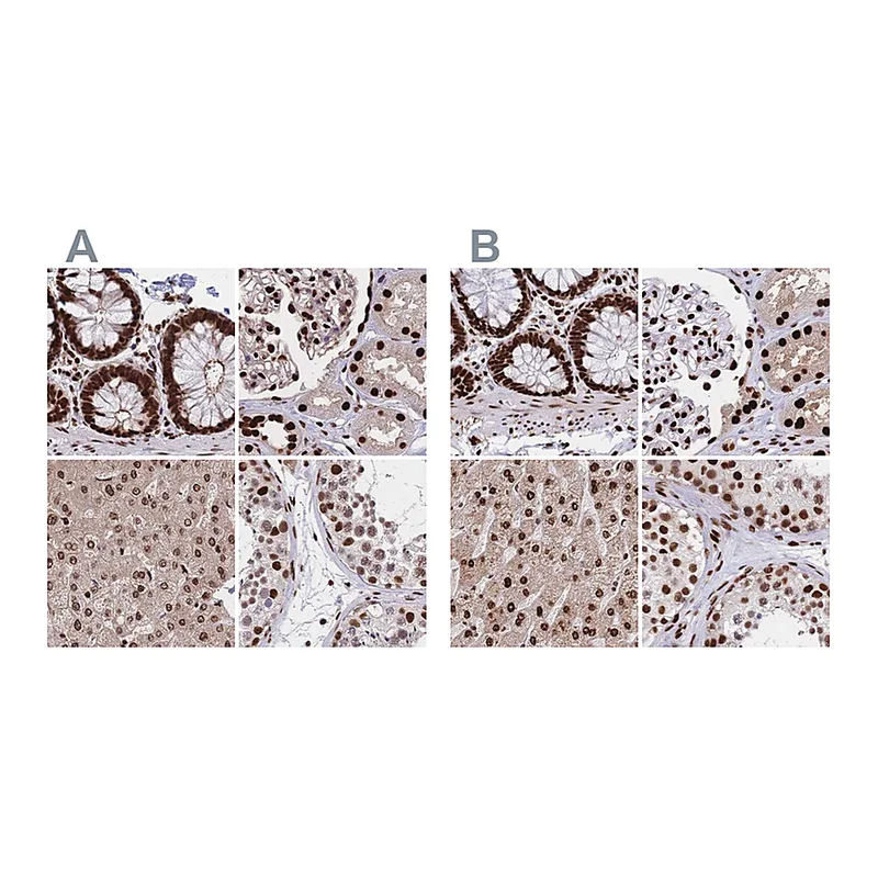 Atlas Antibodies Anti-HDGF Antibody