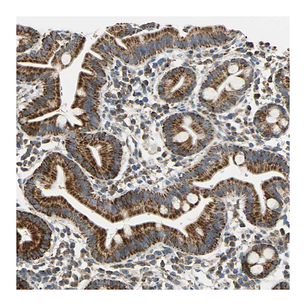 Atlas Antibodies Anti-HDHD5 Antibody
