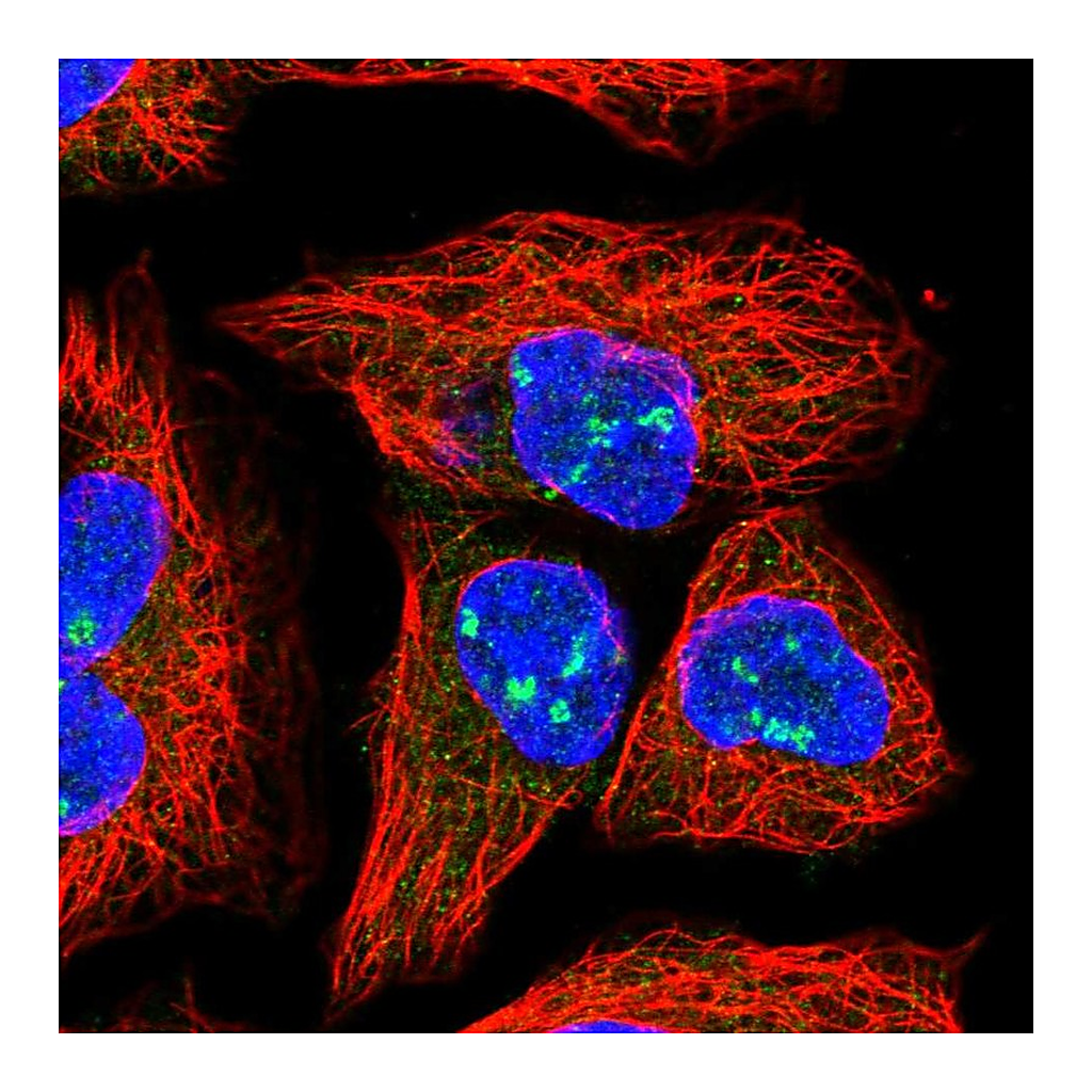 Atlas Antibodies Anti-HEATR1 Antibody