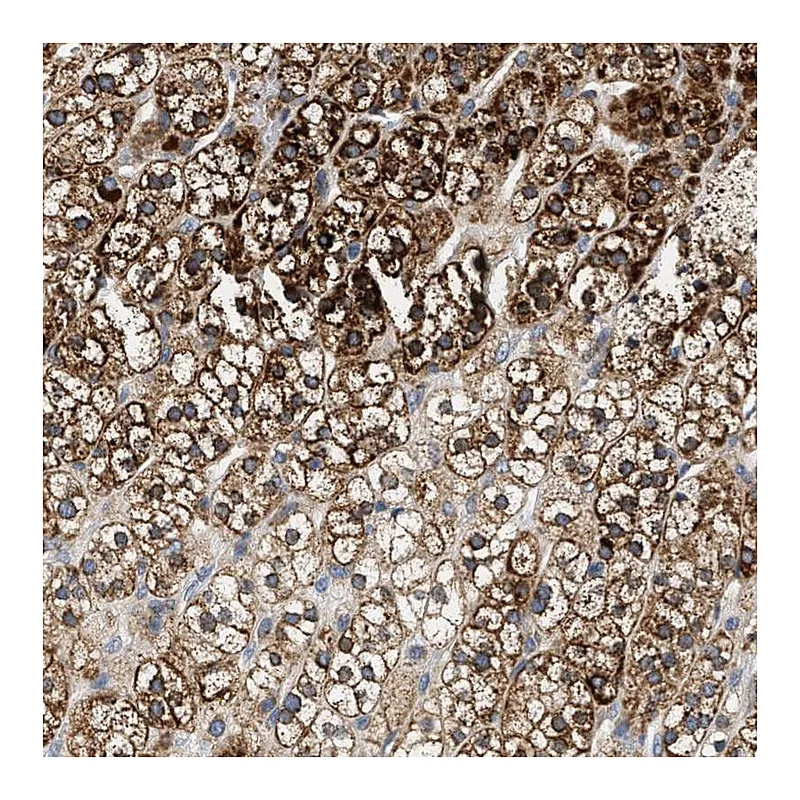 Atlas Antibodies Anti-HDHD3 Antibody