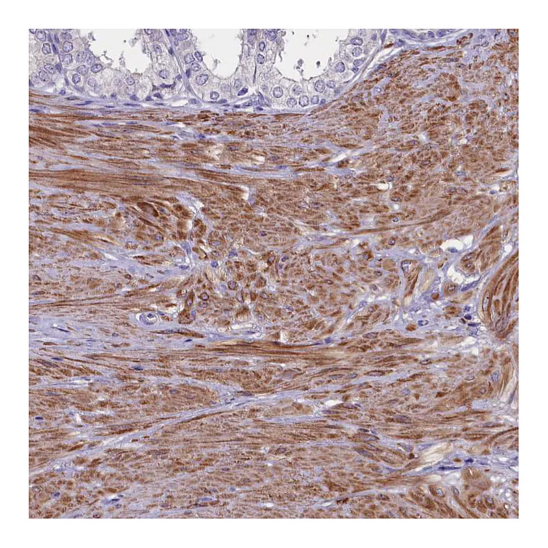 Atlas Antibodies Anti-HEATR3 Antibody