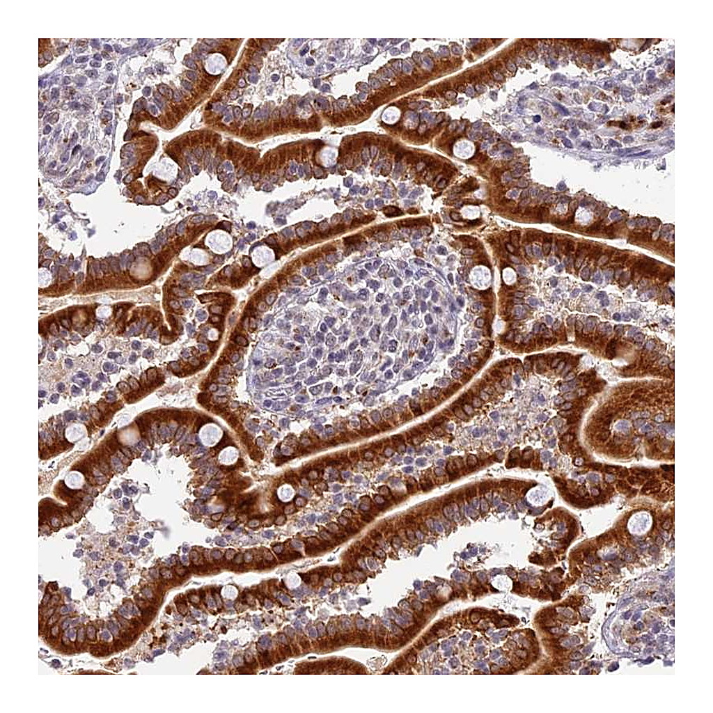 Atlas Antibodies Anti-HEATR5B Antibody