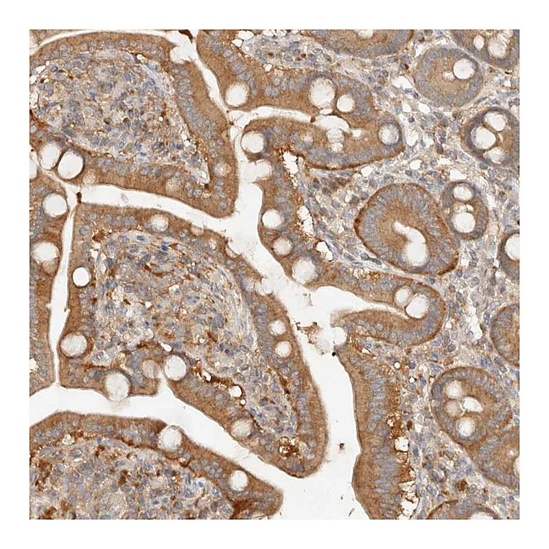 Atlas Antibodies Anti-HECTD3 Antibody