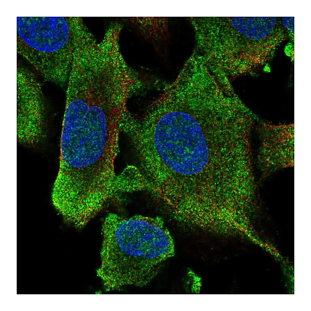Atlas Antibodies Anti-HECW1 Antibody