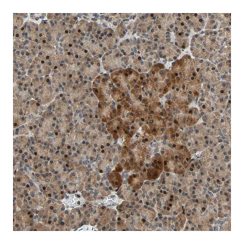 Atlas Antibodies Anti-HECW1 Antibody