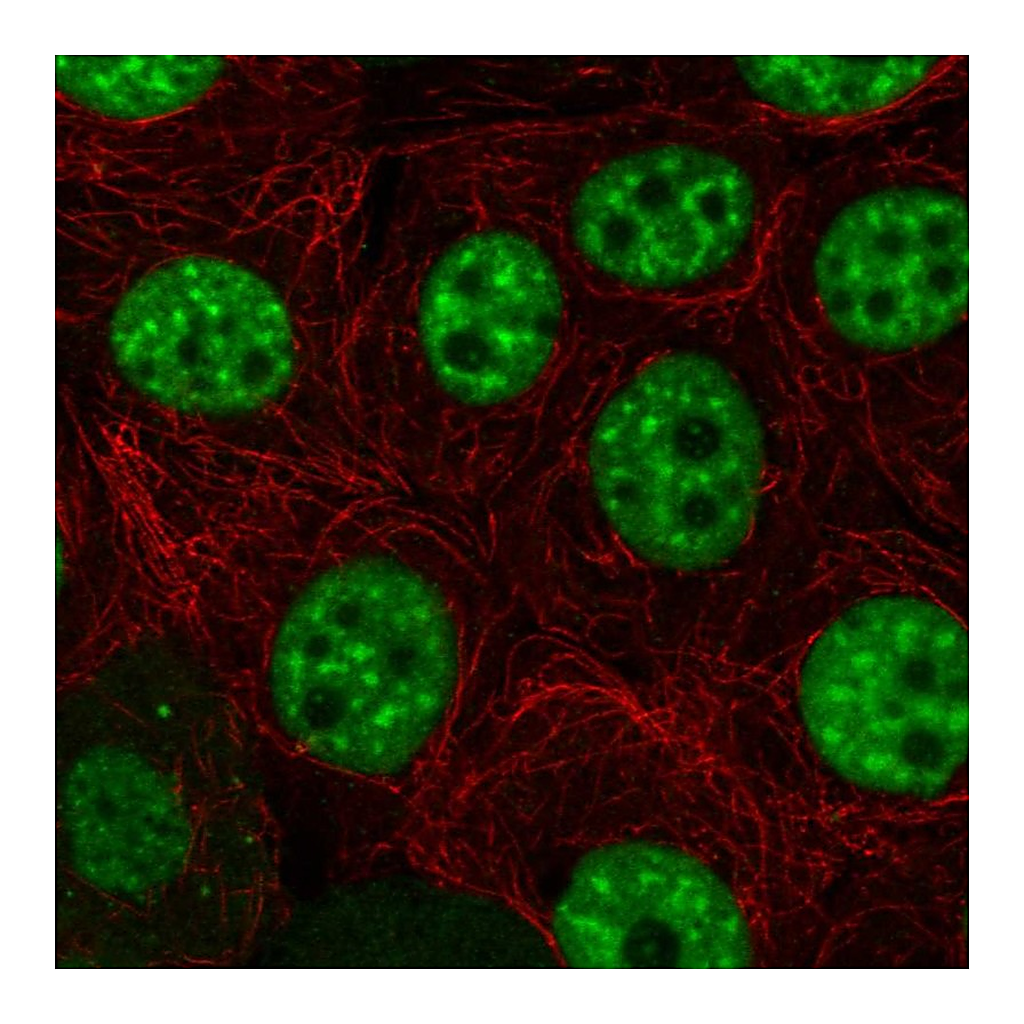 Atlas Antibodies Anti-HELQ Antibody