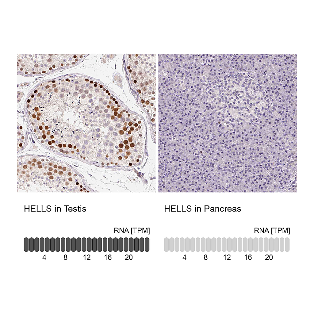 Atlas Antibodies Anti-HELLS Antibody