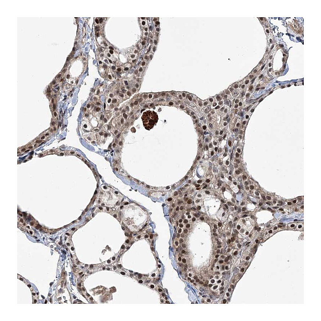 Atlas Antibodies Anti-HELQ Antibody