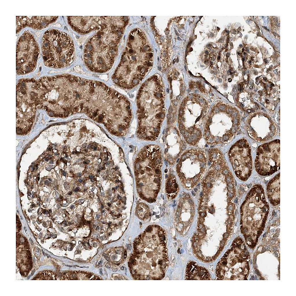 Atlas Antibodies Anti-HEMK1 Antibody