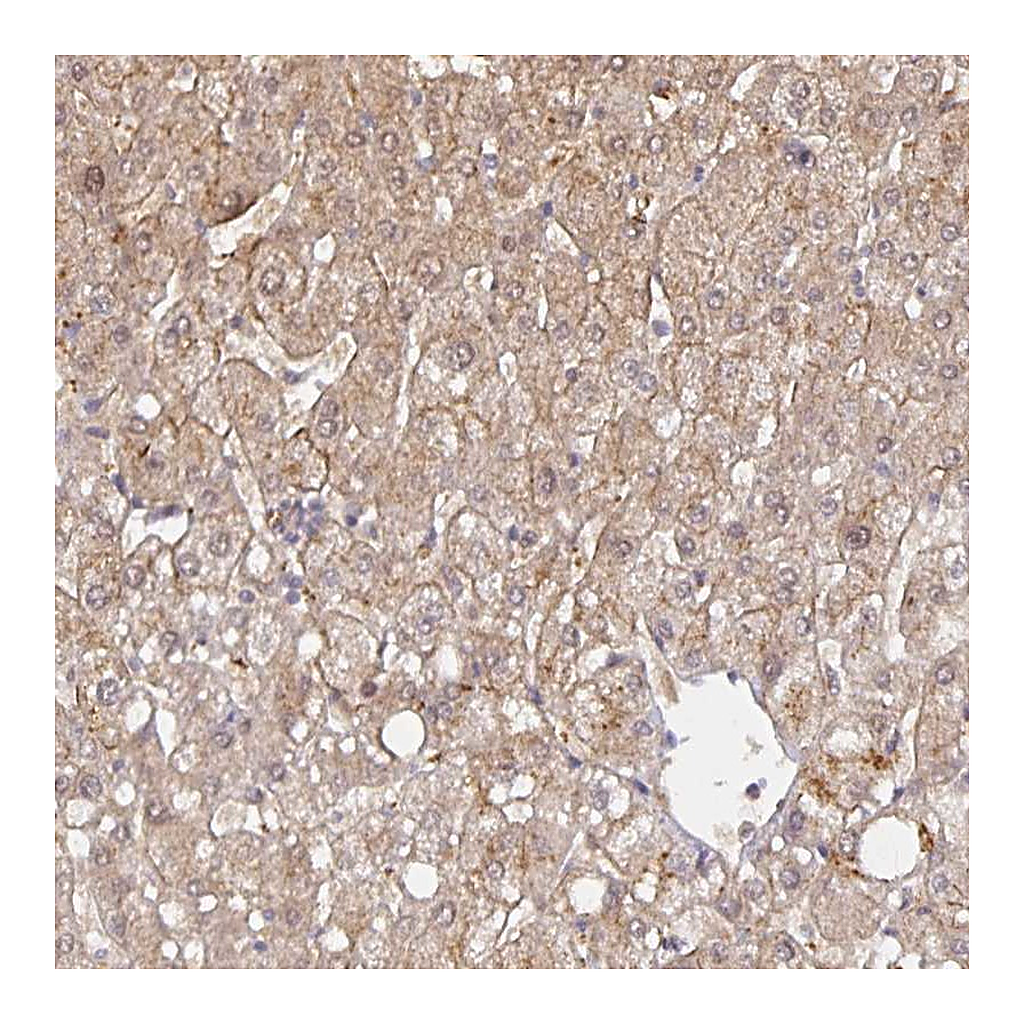 Atlas Antibodies Anti-HEPN1 Antibody